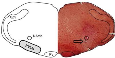 Revisiting differential control of sympathetic outflow by the rostral ventrolateral medulla